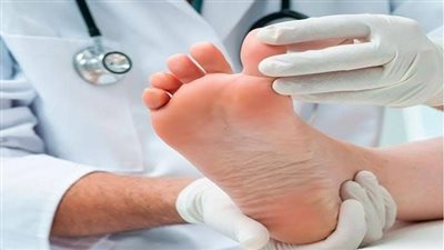طرق الوقاية من القدم السكري.. الاحذية المريحة والاقلاع عن التدخين أبرزها