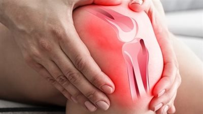 أعراض خشونة الركبة.. التصلب والتورم دلالة مهمة 