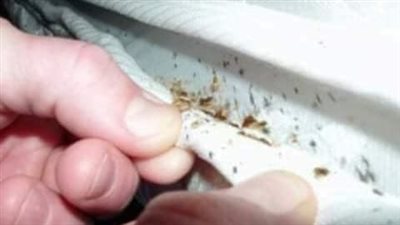 علاج البق.. حشرة طفيلية تعيش على دم الانسان
