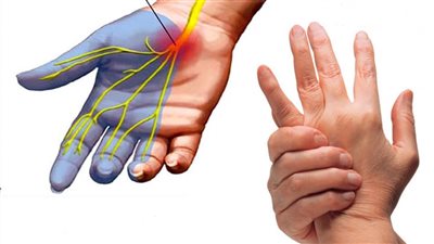 أسباب تنميل الأطراف.. العلاج باتباع نمط حياة صحي 
