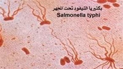 أعراض حمى التيفود والفئات الأكثر تعرضا للاصابة 