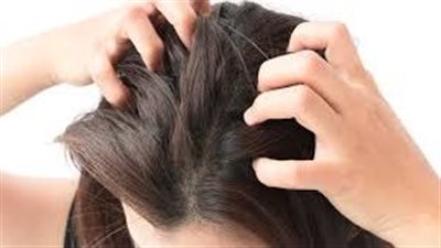 أسباب حكة فروة الرأس وطرق علاجها الطبية