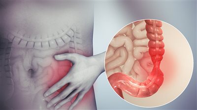 أسباب متلازمة القولون العصبي.. الدراسات الطبية توضح