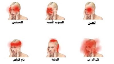 صداع أعلى الرأس.. 4 عوامل محفزة على الألم