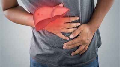 أعراض التهاب الكبد الحاد والمزمن.. تعرف عليها بالعلامات الشائعة