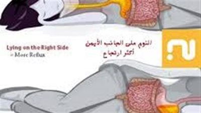 ما يفعله النوم على الجانب الأيسر لتخفيف حرقة المعدة.. الدراسات الطبية توضح